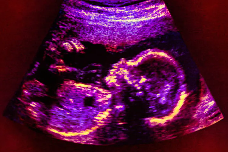 Un grupo de científicos de Estados Unidos creó un embrión humano híbrido, mezclando células masculinas y femeninas, en un experimento que buscaba la cura de las enfermedades de un único defecto genético. Los autores del experimento, el profesor Norbert Gleicher de la Fundación de Medicina Reproductiva de Chicago y un colega, hicieron públicos sus resultados en la reunión anual de la Sociedad Europea de Reproducción Humana y Embriología celebrada esta semana en Madrid.