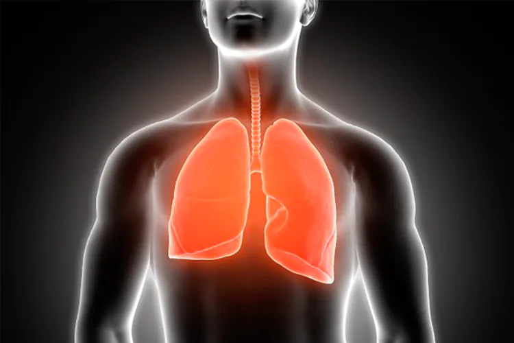 Un gen podría predisponer al cáncer pulmonar.