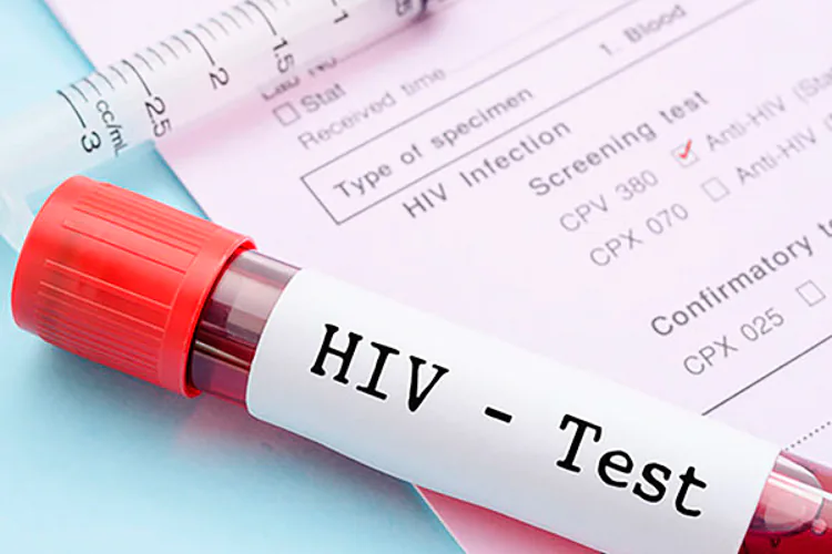 Reducción de los efectos del VIH/SIDA
