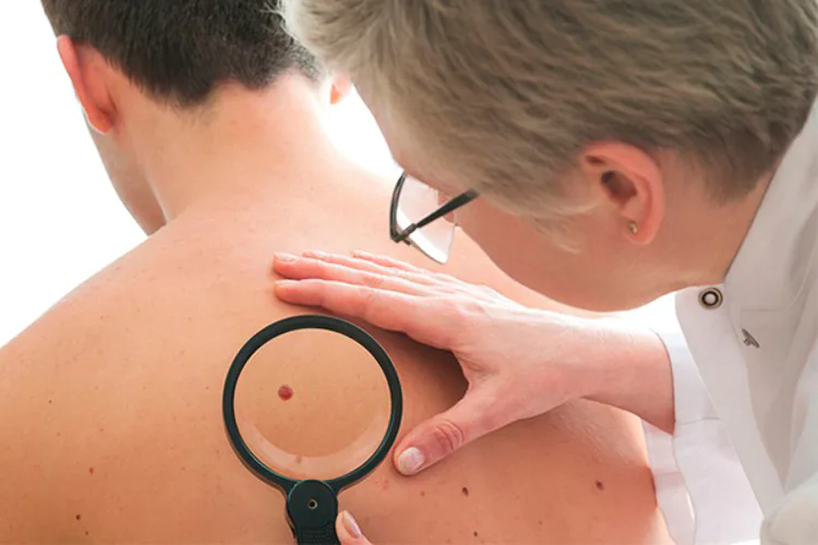 Las novedades en cáncer de piel, el centro del 45 Congreso Nacional de Dermatología