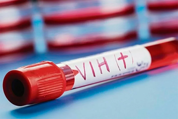 El VIH/sida, de sentencia de muerte a enfermedad crónica