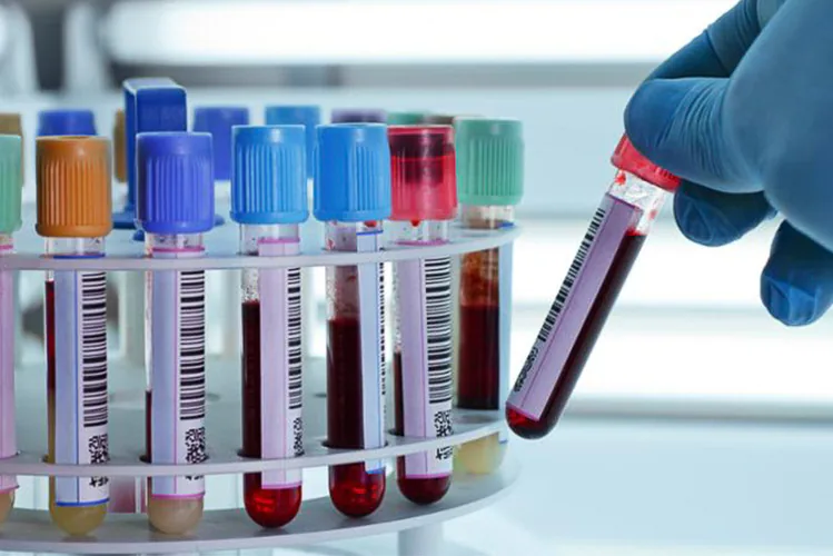 Cuando usted se corta su cuerpo deja de sangrar formando un coágulo (una masa engrosada) de sangre. Unas substancias en su sangre (llamadas proteínas) trabajan con partículas pequeñas (llamadas plaquetas) para formar el coágulo. Formar un coágulo se llama "coagulación". La coagulación ayuda cuando usted está lesionado pues disminuye la pérdida de sangre. Sin embargo, su sangre no se debería coagular cuando se está moviendo a través de su cuerpo.