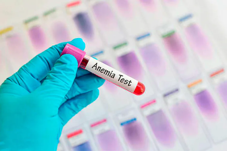 Los tejidos del organismo, requieren un aporte continuo de oxigeno, nutrientes y electrolitos para su funcionamiento normal.En las anemias se presentan valores de glóbulos rojos o de hemoglobina inferiores a los normales.