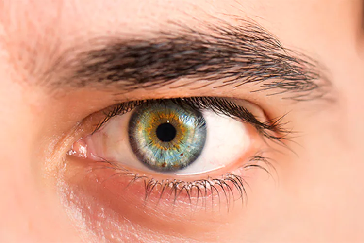 El melanoma intraocular, un cáncer poco común, es una enfermedad en la cual se encuentran células cancerosas (malignas) en la parte del ojo llamada la úvea. La úvea incluye el iris (la parte de color del ojo), el cuerpo ciliar (un músculo en el ojo) y la coroides (una capa de tejido en la parte posterior del ojo). El iris se abre y se cierra para controlar la cantidad de luz que entra en el ojo. El cuerpo ciliar cambia la forma del lente dentro del ojo para que pueda enfocarse.